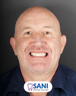 Before from Justin Fish